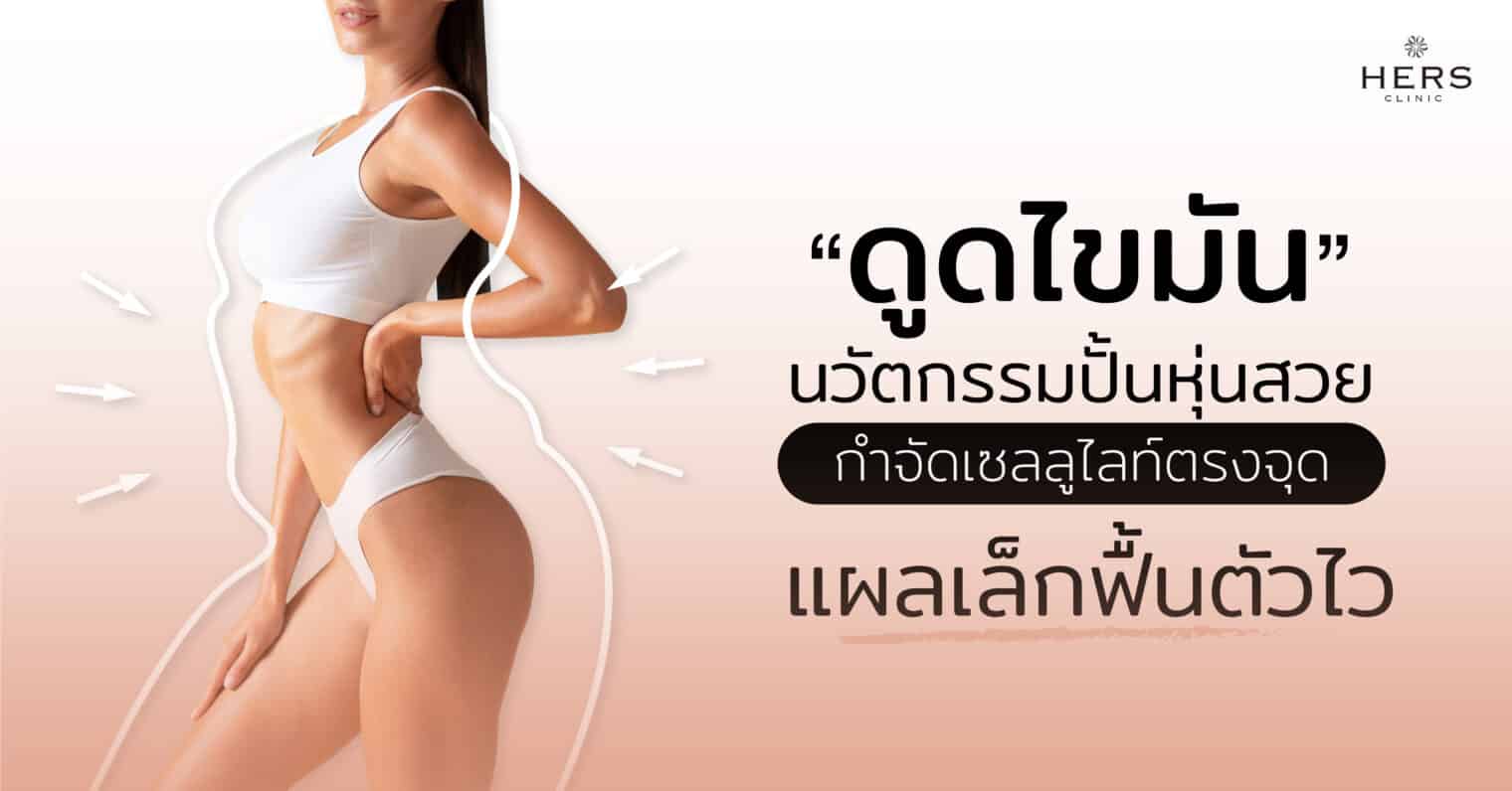 "ดูดไขมัน" นวัตกรรมปั้นหุ่นสวย กำจัดเซลลูไลท์ตรงจุด แผลเล็กฟื้นตัวไว