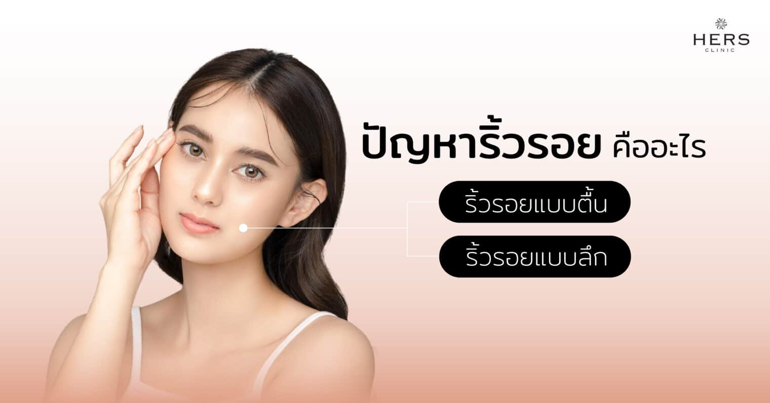 ปัญหาริ้วรอย คืออะไร