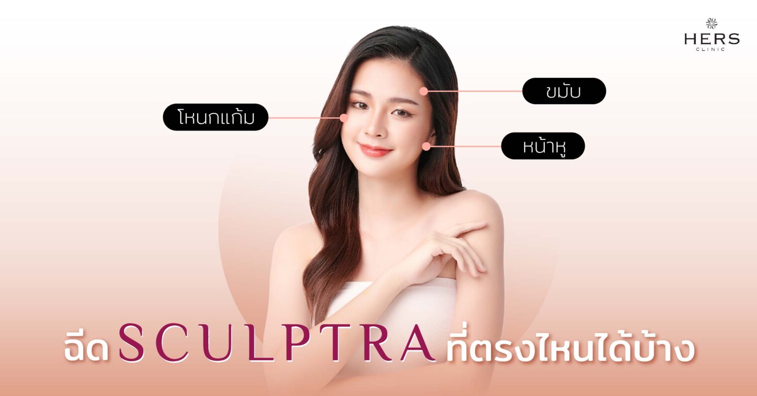 ฉีด Sculptra ที่ตรงไหนได้บ้าง